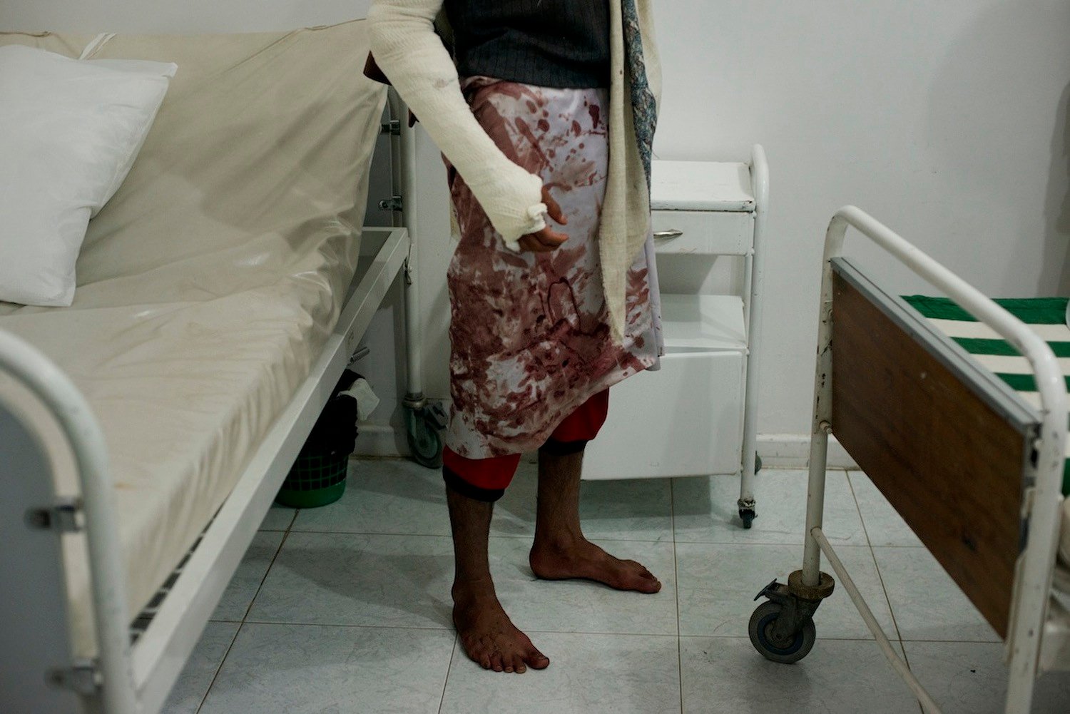 A Yemeni man stands in al Moaiyed Hospital after being wounded by live ammunition fired by government troops.