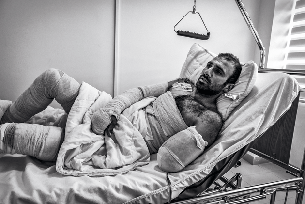 Halo Ramishtee, a wounded Kurdish mine-clearance expert, at the Swedish Specialist Hospital, Erbil