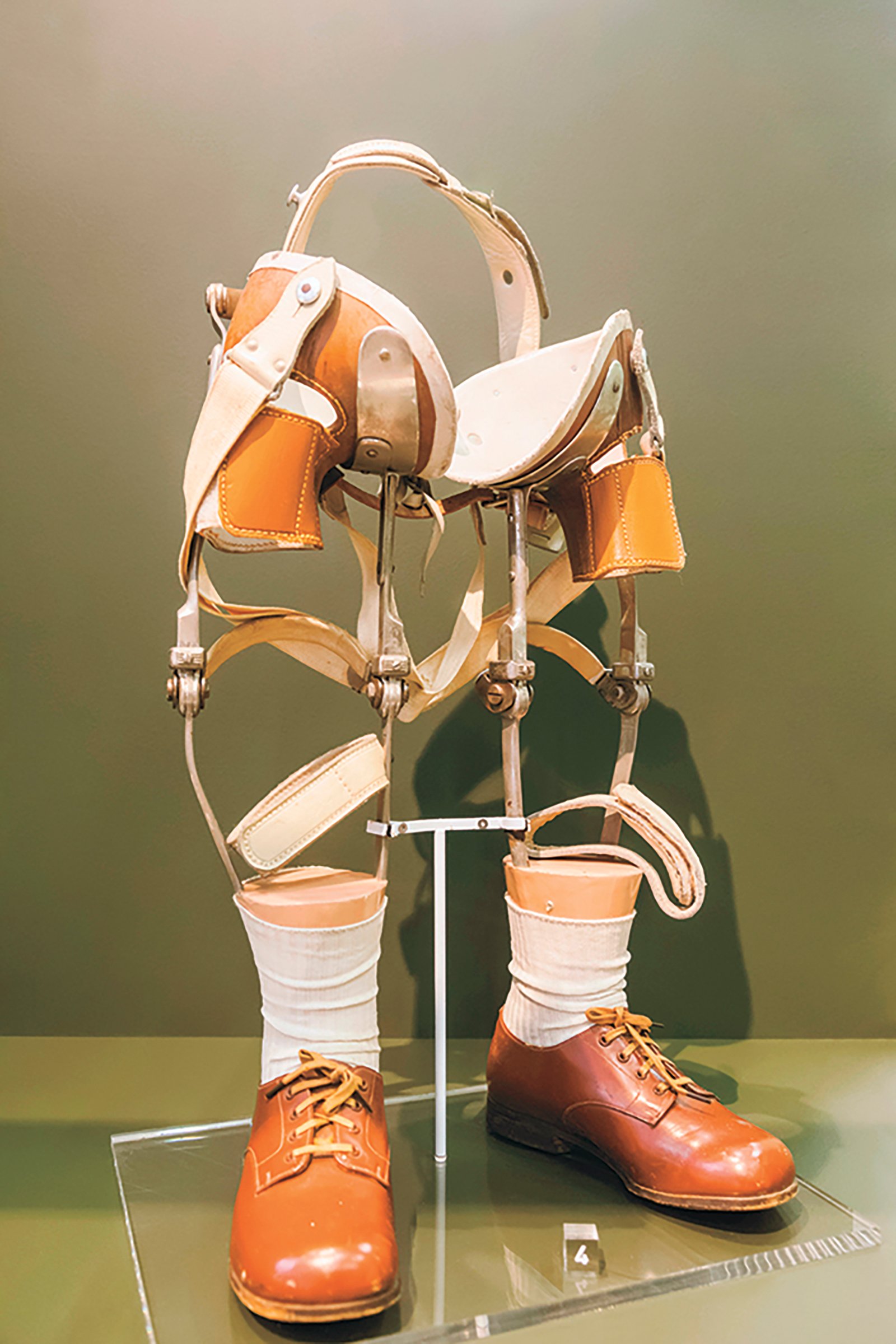 Prosthesis for a child affected by thalidomide, London Science Museum © mauritius images GmbH/Alamy